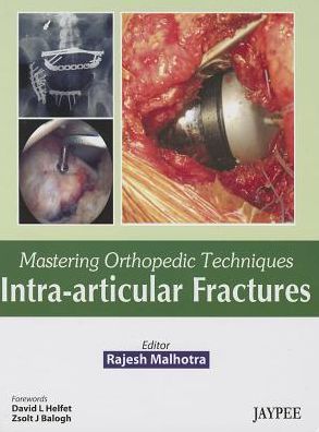 Mastering Orthopedic Techniques Intra-Articular Fractures