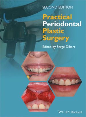 Practical Periodontal Plastic Surgery, 2e