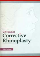 Corrective Rhinoplasty, 3e (HB)