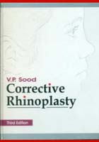 Corrective Rhinoplasty, 3e (HB)