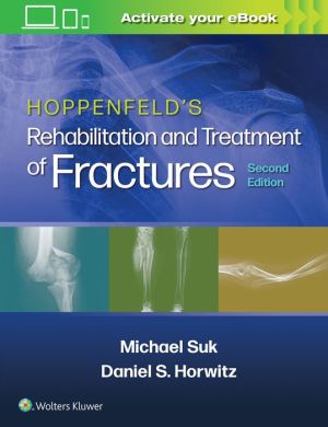 Hoppenfeld's Treatment and Rehabilitation of Fractures, 2e