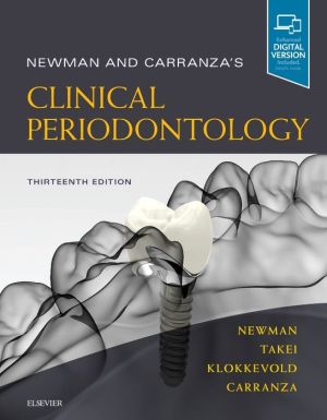 Newman and Carranza's Clinical Periodontology, 13e**