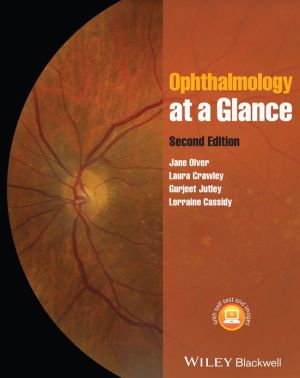 Ophthalmology at a Glance