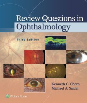 Review Questions in Ophthalmology, 3e
