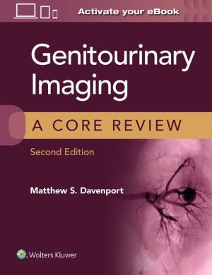 Genitourinary Imaging: A Core Review, 2e