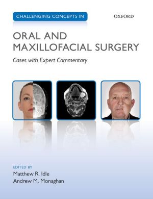 Challenging Concepts in Oral and Maxillofacial Surgery : Cases with Expert Commentary