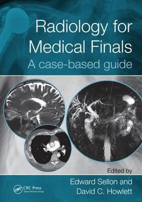 Radiology for Medical Finals: A case-based guide