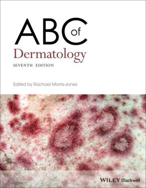 ABC of Dermatology, 7e