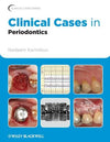 Clinical Cases in Periodontics** | Book Bay KSA