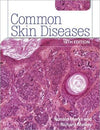 Common Skin Diseases, 18e
