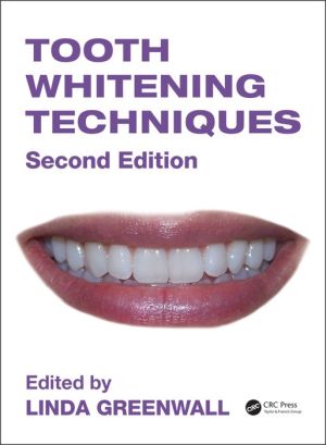 Tooth Whitening Techniques, 2e | Book Bay KSA