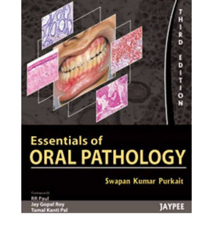 Essential of Oral Pathology