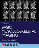 Basic Musculoskeletal Imaging, 2e