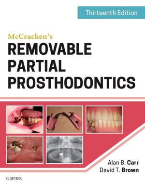 McCracken's Removable Partial Prosthodontics, 13e