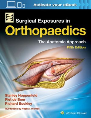 **Surgical Exposures in Orthopaedics: The Anatomic Approach, 5E