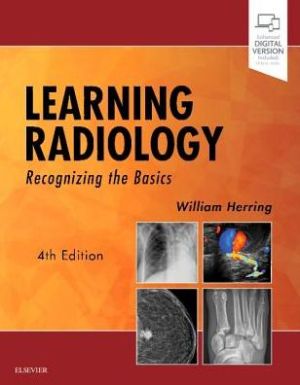 Learning Radiology : Recognizing the Basics, 4e**