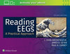 Reading EEGs: A Practical Approach, 2e