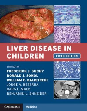 Liver Disease in Children, 5e
