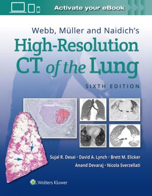 Webb, Müller and Naidich's High-Resolution CT of the Lung, 6e